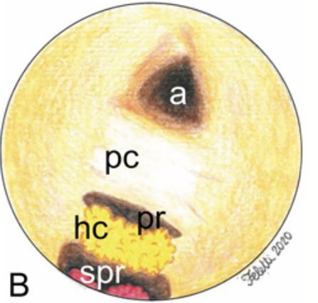 Anatomia normale del terzo ventricolo