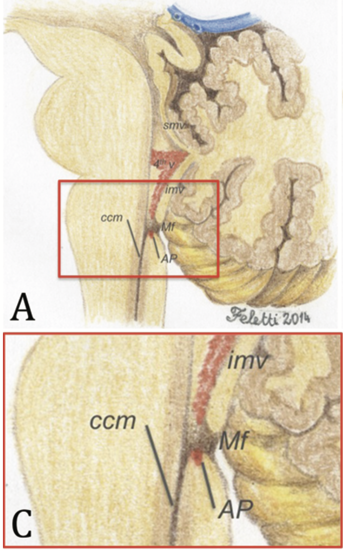 Area postrema – vista sagittale
